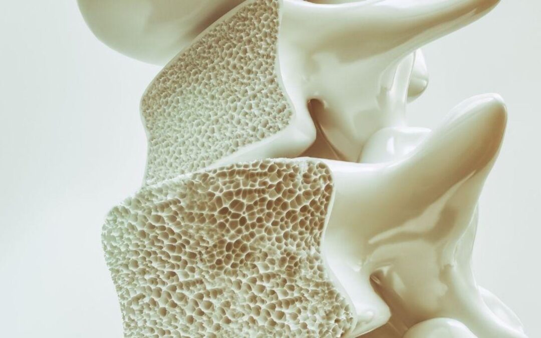 Cómo cuidar tus huesos y mantener alejada la osteoporosis